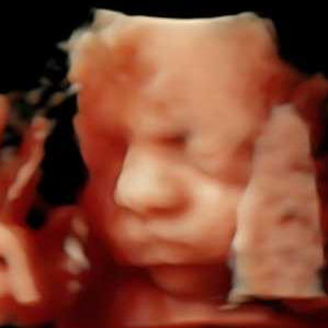 Original 4d ultrasound image of a preborn baby