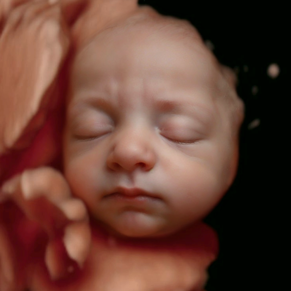 Conversion of ultrasound scan to baby photo