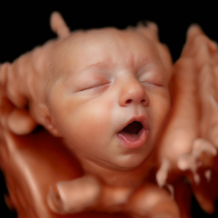 Conversion of ultrasound scan to baby photo