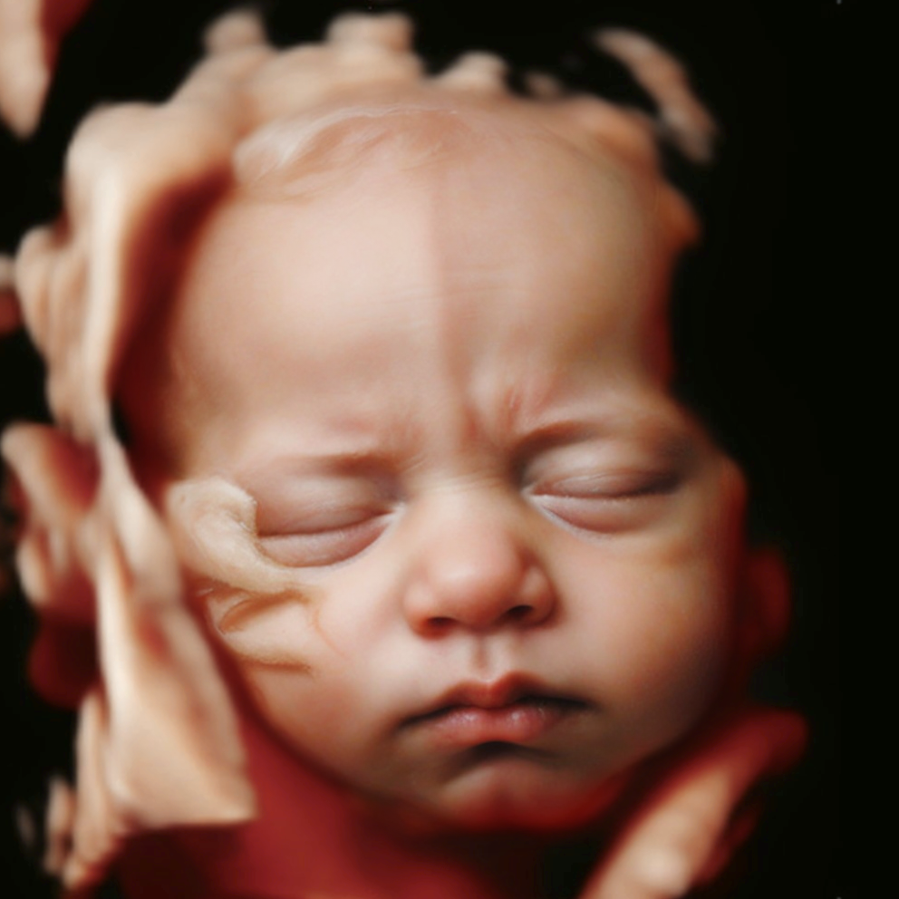 Conversion of ultrasound scan to baby photo