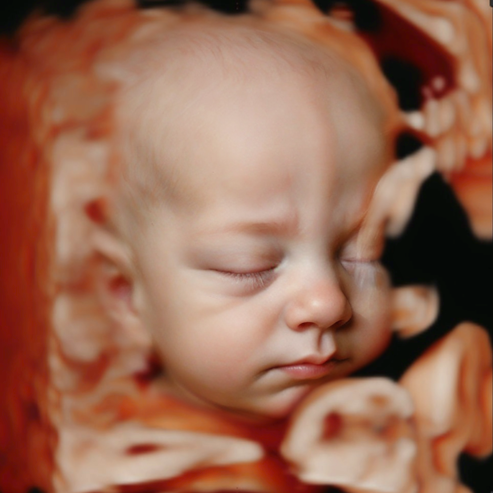 Conversion of ultrasound scan to baby photo