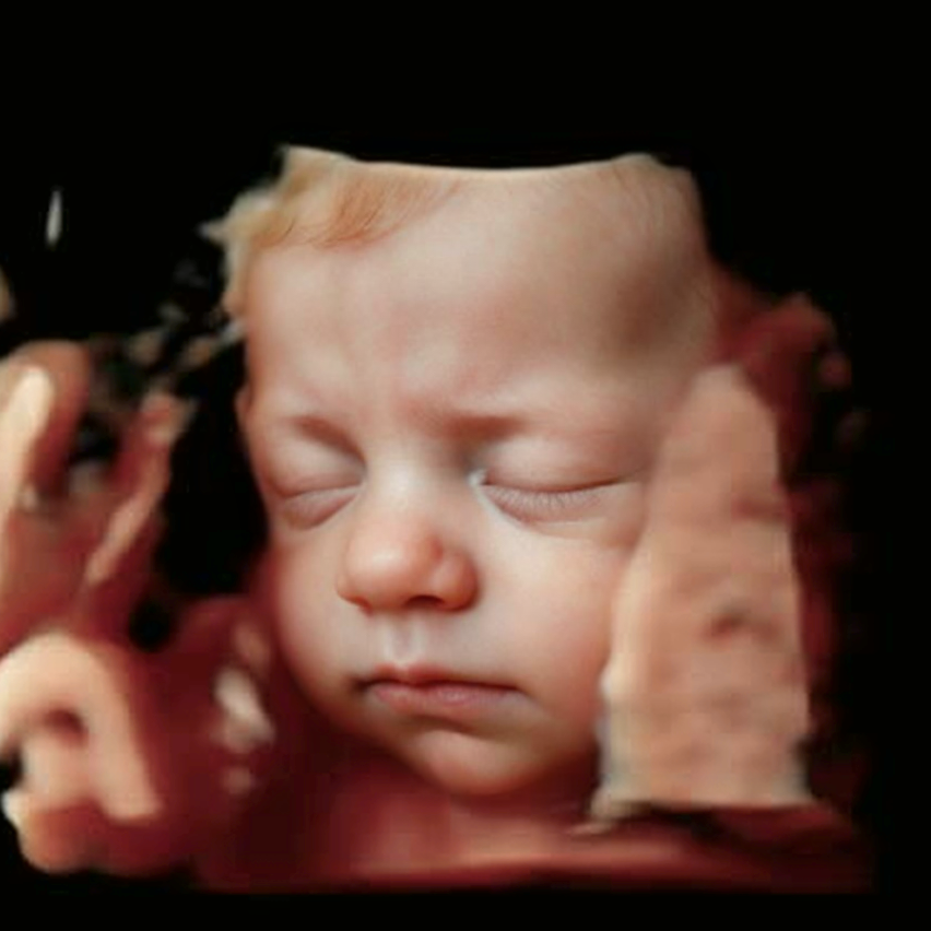 Conversion of ultrasound scan to baby photo