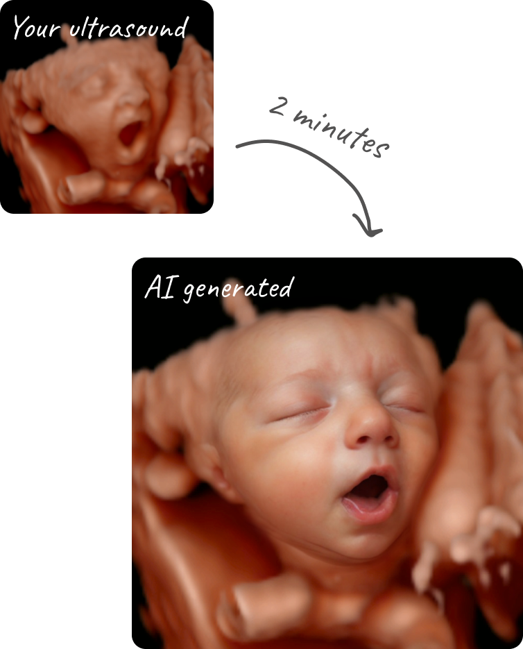 Transformation of a 4d ultrasound image of a preborn baby into a photo realistic picture